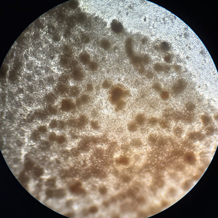 Colonias de bacterias