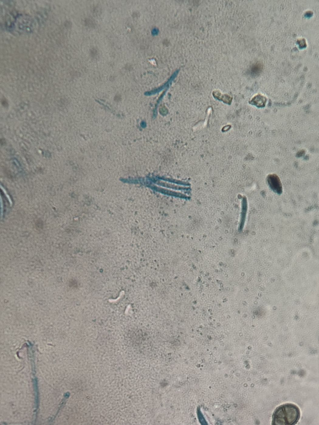 Esporas de hongos teñidas de azul