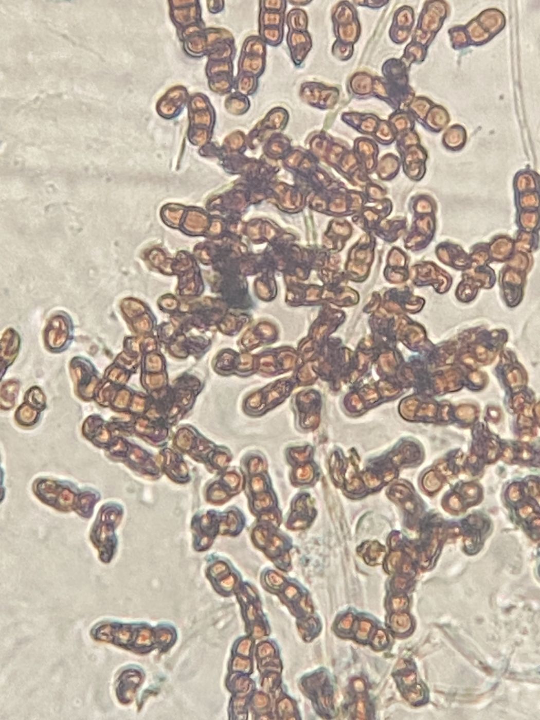 Esporas de hongo al microscopio